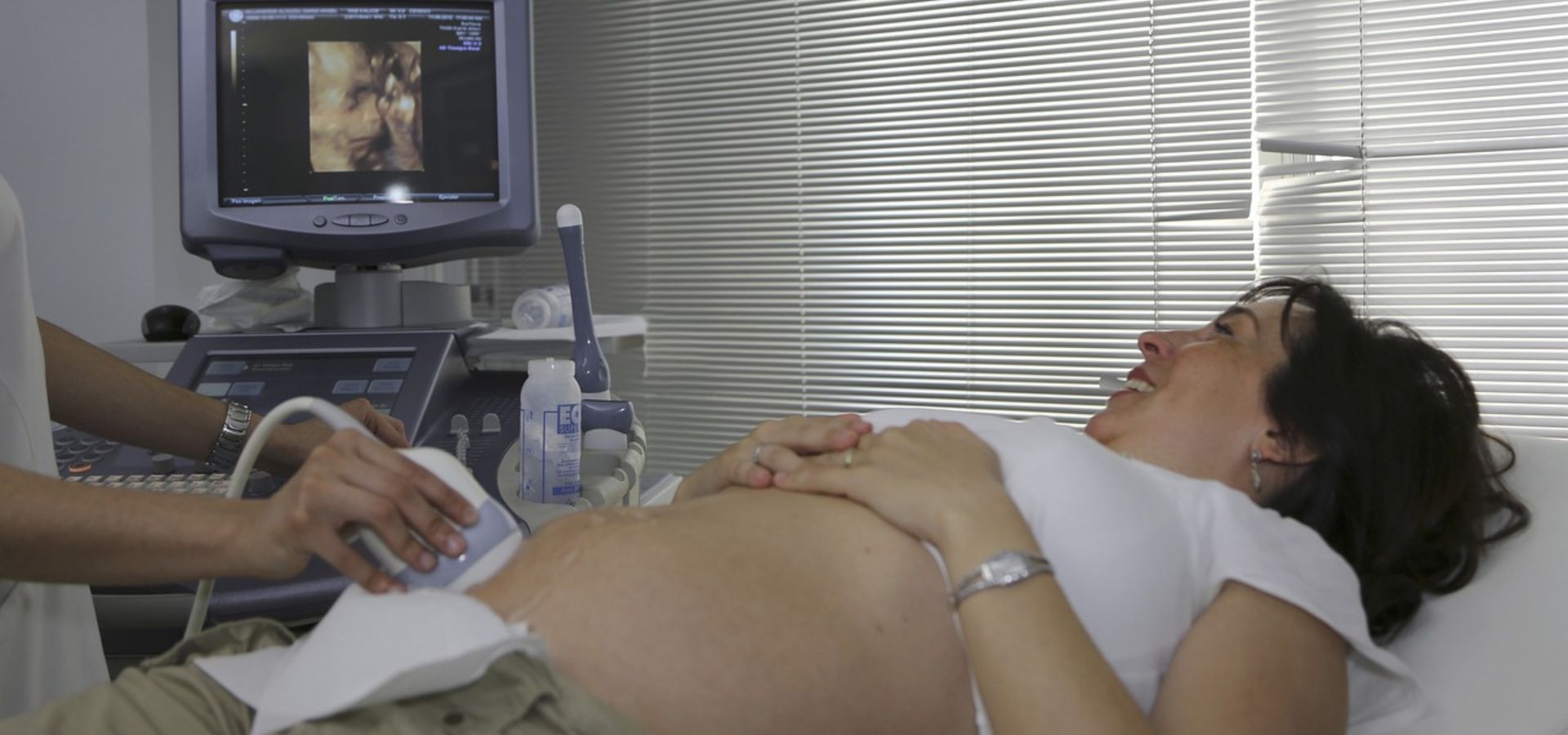 3D and 4D Ultrasounds